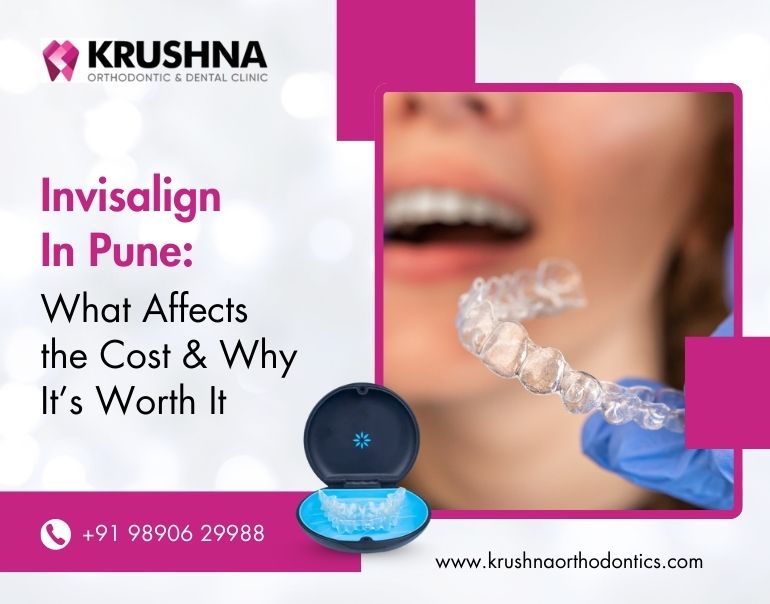 Invisalign in Pune: What Affects the Cost & Why It’s Worth It