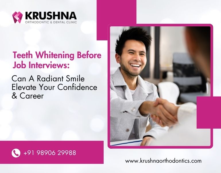 Teeth Whitening Before Job Interviews: Can a Radiant Smile Elevate Your Confidence and Career?