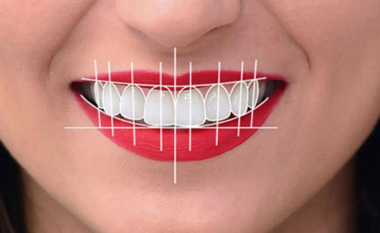Digital Smile Design Dattawadi Pune Digital Smile Design Sinhagad Road Dattawadi Pune