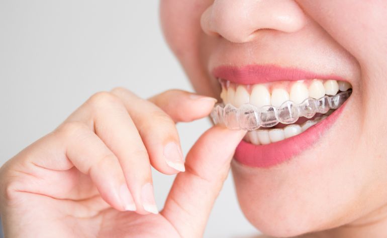 Invisible Braces Treatment sinhagad road Dattawadi Pune 