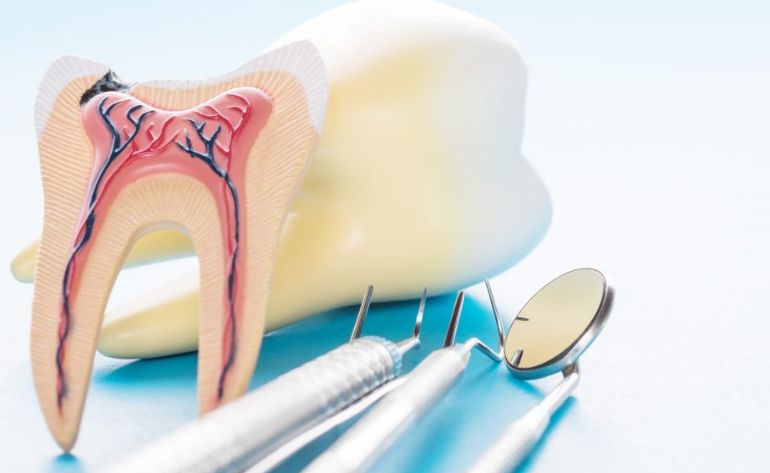 root canal treatment in Sinhagad Road Pune 