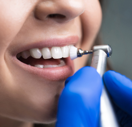 dental clinic in Sinhagad Road pune