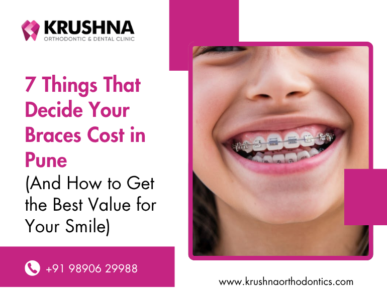 7 Things That Decide Your Braces Treatment Cost in Pune