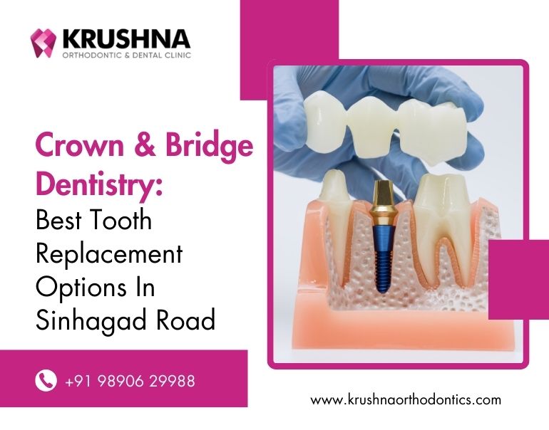 Crown & Bridge Dentistry: Best Tooth Replacement Options in Sinhagad Road