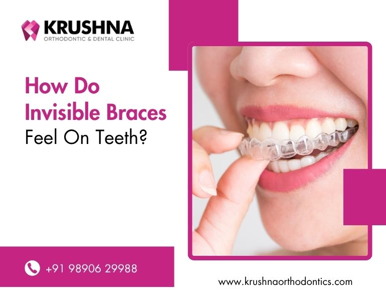 How Do Invisible Braces Feel On Teeth?