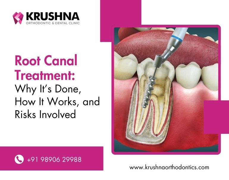Root Canal Treatment: Why It’s Done, How It Works, and Risks Involved