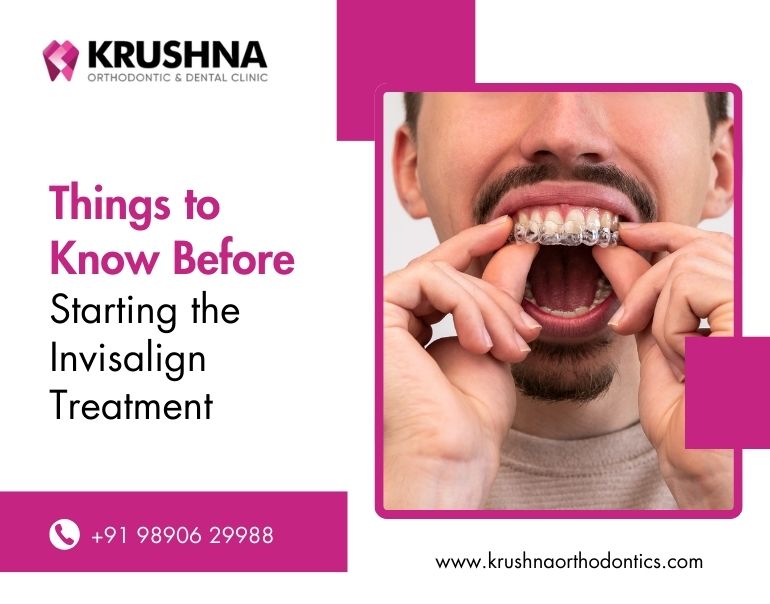 Things to Know Before Starting the Invisalign Treatment